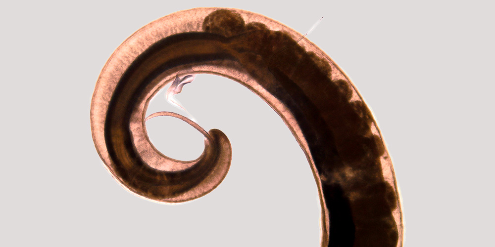Neue parasitäre Wurmart entdeckt 